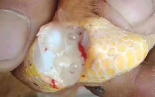 雞拉綠色糞便的原因，感染傷寒、患上禽霍亂等因素均會導(dǎo)致