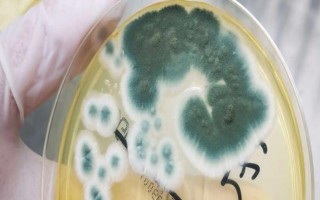 食用菌青霉菌的發(fā)生癥狀，會分泌毒素造成食用菌菌絲死亡